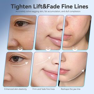 เครื่องนวดหน้ากัวซาไมโครเคอร์เรนท์แบบใหม่ พร้อมระบบดูดไขมัน ช่วยกระชับใบหน้า ยกกระชับลำคอ และลดเลือนริ้วรอย - Product Image 5