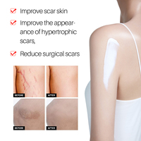 Améliore l'apparence des cicatrices d'acné Silicone Scar Gel 30g