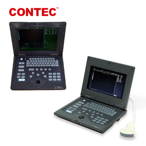 Équipement diagnostique vétérinaire courant limité de scanner animal portatif CMS600P-VET d'ultrason - Product Image 3