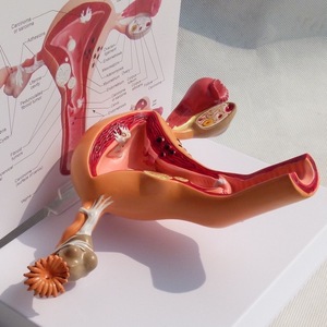 Modelo de Patología del Útero Humano para Ciencias Médicas, Modelo de Enfermedad Órgánica, Modelo Antidrogas - Product Image 6