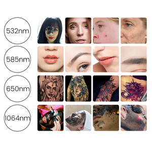 2025 chuyên nghiệp picolaser q-switch Nd Yag Pico Xóa hình xăm bằng laser picosecond Máy Xóa hình xăm bằng laser Pico Máy - Product Image 6