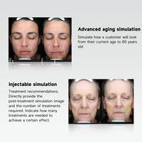 Équipement de scanner facial DX, analyseur de détection des problèmes cutanés potentiels, de l'acné et des imperfections pour le diagnostic du visage