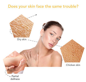 En stock Arbutina orgánica para eliminar la piel de <span class=keywords><strong>ganso</strong></span>, cuidado suave, reparación de piel dañada, loción corporal blanqueadora de colágeno hidratante - Product Image 3