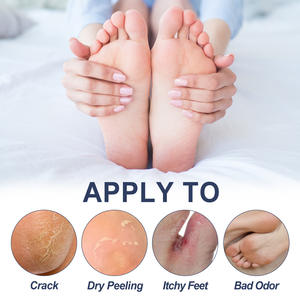 Usine OEM/ODM médecine chinoise à base de plantes grande qualité FOOT Fungus Odor CARE SPRAY - Product Image 6