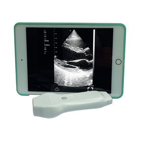 USB 2-IN-1 Phasen-Linear-Farb-Doppler-Ultraschallgerät drahtloser Echoscanner - Product Image 5