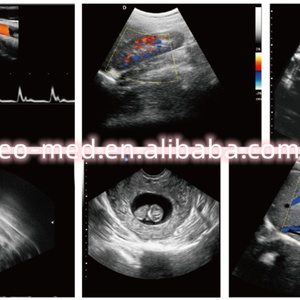 Échographe Doppler Couleur sur Chariot Économique avec Moniteur Médical LED 19'' TC31 - Product Image 6