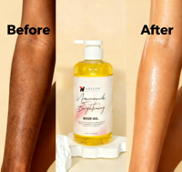Niacinamide et vitamine E Pénétration profonde Réduire les taches brunes Huile corporelle éclaircissante blanchissante