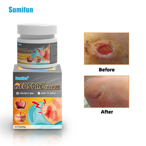 Série d'onguents Sumifun pour le soin de la peau et la santé des personnes âgées - Commerce extérieur transfrontalier - Product Image 4