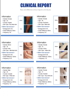 Productos para Dropshipping 2026: Lo Mejor en Depilación Permanente con Enfriamiento de Hielo de 3 y 4 Ondas, Depiladora de Diodo sin Agujas para el Cuidado del Cabello y Belleza - Product Image 5