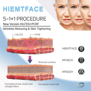 Appareil de beauté pour le visage et le corps BECO 7 Pads HIEMS PCRF, stimulateur musculaire, raffermissant de la peau, élimination des rides et des poches sous les yeux - Product Image 2
