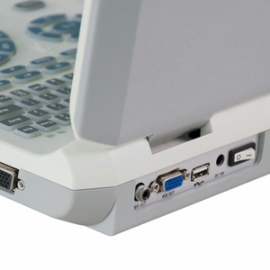 China <strong>Supplier</strong> Vet &amp; Human Use Pc Platform B/W Full Digital Ultra Sound <strong>Scan</strong> <strong>Ultrasound</strong> Machine - Product Image 5