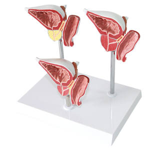 एनाटॉमी पुरुष पैथोलॉजिकल परिवर्तन प्रोस्टेट मॉडल चिकित्सा विज्ञान शैक्षिक आपूर्ति चिकित्सा शिक्षण सहायता - Product Image 3