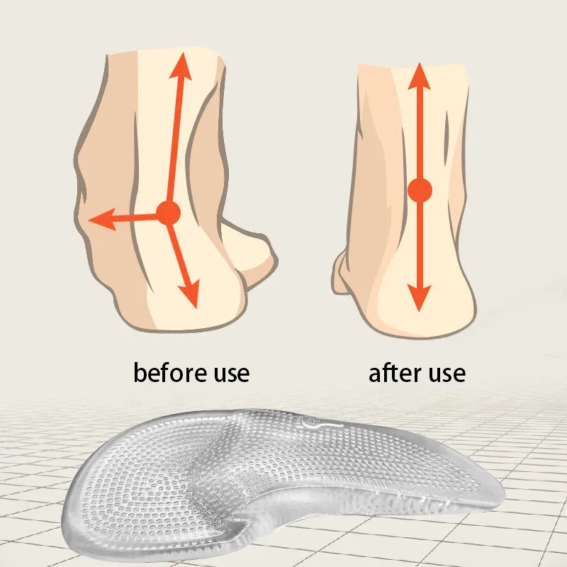 도매 특수 실리콘 젤 아치 지원 깔창 올바른 플랫 피트 방지 발 통증 보호 발 아치 깔창 하이힐 용