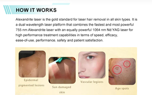 Système de laser diode 755nm 1064nm Épilation au laser diode pour peaux foncées - Product Image 3