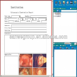 SW-3303 डिजिटल ऑप्टिकल कोपोस्कोप/अस्पताल डिजिटल इलेक्ट्रॉनिक कोपोस्कोप - Product Image 6