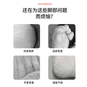 Kit d'outils de pédicure 27 pièces avec lime à pieds, pierre ponce, éliminateur de callosités pour adulte, kit de manucure et pédicure portable - Product Image 2