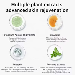 Nhãn hiệu riêng chống mụn trứng cá thiết lập nhà máy chiết xuất mặt toner và Lotion làm trắng và loại bỏ mụn trứng cá mụn mặt chống mụn trứng cá Kem - Product Image 6