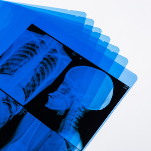 Película de Imagenología Seca Médica Fujifilm Premium para Diagnóstico Radiológico Profesional - Product Image 1