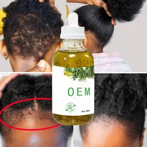 Aceite Natural orgánico para el cabello y el cuero cabelludo con logotipo personalizado, aceite Ayurveda para tratamiento profundo, aceite para crecimiento del cabello de bebé para niños