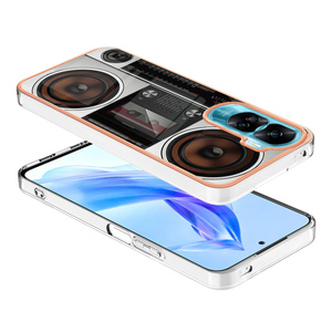 Cadre de galvanoplastie coque de téléphone pour Huawei <span class=keywords><strong>Honor</strong></span> 90 Lite X9A Magic 5 Pro X8A X7A X6 housse en TPU antichoc pour Google Pixel 6A <span class=keywords><strong>7A</strong></span> - Product Image 5