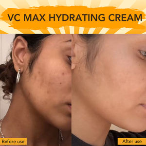 LKIAE Prodotti per il Viso Cura della Pelle Naturale Organica Idratante Crema Viso e Lozione Anti-Età con Vitamina C 5% e Collagene (vecchio2) - Product Image 4