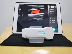 Sonde à ultrasons sans fil à double tête 80 éléments <span class=keywords><strong>3</strong></span> en 1 - Product Image 5