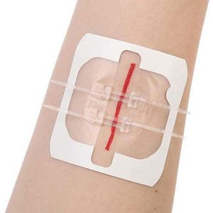 Professional Ozone-Disinfecting Surgical Silk Plaster <b>Athletic</b> <b>Tape</b> - Product Image 5