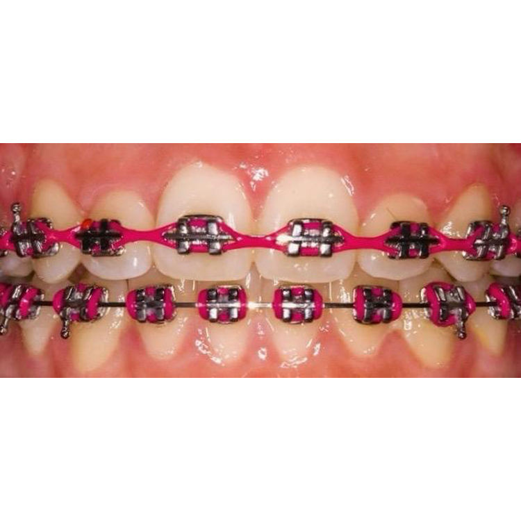 Strumenti Di Utilità Ortodonzia Elastici - Legature - Bande Asa Dental - Foto 7