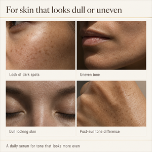Suero Facial OEM de Marca Privada con Niacinamida y Ácido Tranexámico <span class=keywords><strong>para</strong></span> Corregir Manchas Oscuras y Aportar Luminosidad, Cuidado Facial - Product Image 3