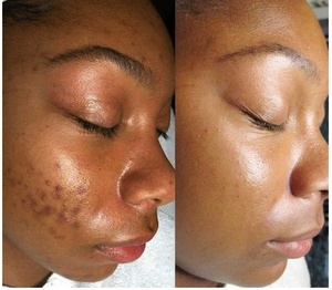 <span class=keywords><strong>Set</strong></span> OEM per la Cura della Pelle con Siero, Sapone, Crema e Lozione al Collagene Organico, Anti-Età e Sbiancante - Product Image 6