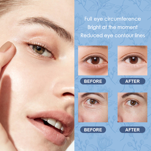 <span class=keywords><strong>Crema</strong></span> de <span class=keywords><strong>Ojos</strong></span> de Belleza al por Mayor, la Más Vendida, Repara las <span class=keywords><strong>Bolsas</strong></span> de <span class=keywords><strong>los</strong></span> <span class=keywords><strong>Ojos</strong></span>, Elimina las Arrugas, Vitamina E, Antienvejecimiento, <span class=keywords><strong>Crema</strong></span> Instantánea <span class=keywords><strong>para</strong></span> Levantar <span class=keywords><strong>los</strong></span> <span class=keywords><strong>Ojos</strong></span> - Product Image 6