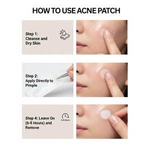 Patchs Hydrocolloïdes Grand Format pour Boutons, Uniques pour le Corps, les Joues, le Front, le Visage, Emballage Personnalisable – Vente en Gros - Product Image 3