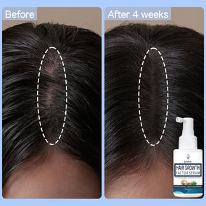 Qquaker Meilleure vente Réparation Follicules 3% Redensyl Croissance Réduire la perte de cheveux <span class=keywords><strong>Spray</strong></span> Sérum capillaire de marque privée - Product Image 6