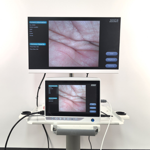 Direkt vom Hersteller Wieder verwendbares flexibles Endoskop ohne Faser für Hunde Bronchus Medizinische Geräte für Haustiere - Product Image 5