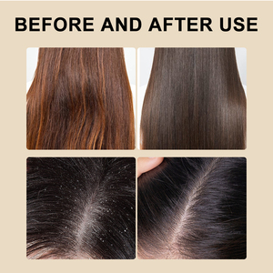 Champú Sólido Herbal Usnea Grass Cacumen Biotae, Champú Sólido Natural OEM para <span class=keywords><strong>el</strong></span> Cuidado del <span class=keywords><strong>Cuero</strong></span> <span class=keywords><strong>Cabelludo</strong></span> y Anticaspa - Product Image 5