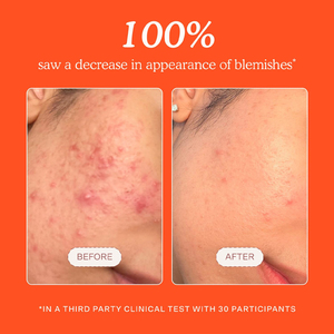 Spray de Ácido Hipocloroso de Marca Privada OEM, Reduce el Enrojecimiento, Calmante, Hidratante, Productos para el Cuidado de la <span class=keywords><strong>Piel</strong></span>, Tónico Facial en Aerosol - Product Image 5