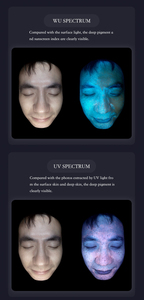 Test d'hydratation de la peau Rajeunissement du visage Détecteur de problèmes faciaux portable Série de Tester-q1 de la peau Machine faciale Commodité - Product Image 3