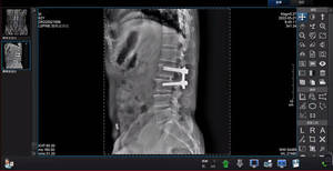Mesin detektor medis <span class=keywords><strong>Digital</strong></span> portabel, mesin pendeteksi Panel datar 14*17 nirkabel - Product Image 6
