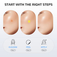 Patchs anti-acné hydrocolloïdes personnalisés en forme de cœur pour le soin des imperfections cutanées