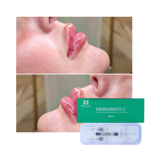 Prix surprise - 2 ml d'<span class=keywords><strong>acide</strong></span> <span class=keywords><strong>hyaluronique</strong></span> pour le remplissage des lèvres, augmentation des lèvres, <span class=keywords><strong>injection</strong></span> pour l'élargissement des lèvres - Product Image 6