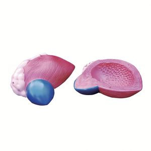 Modèle de vessie humaine KyrenMed avec modèle anatomique de la prostate 2 parties élargissement 3X - Product Image 1