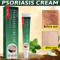 Crema Herbal Zourunan para el Cuidado de la Piel 20g, Cuidado Diario Suave, Tubo Verde, para Uso Externo, Venta al por Mayor y Menor, OEM, Marca Privada
