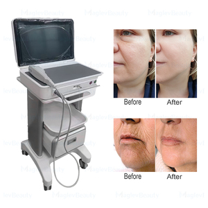Máquina Profesional de Belleza Facial con Ultrasonido Focalizado de Alta Intensidad (<span class=keywords><strong>HIFU</strong></span>) No Invasiva, Eliminación de Arrugas, Adelgazamiento Corporal - Product Image 6