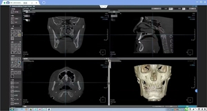 Máquina de Tomografía Computarizada <span class=keywords><strong>Dental</strong></span> de Segunda Mano, Soporte para Video/Inspección en Sitio, Opción Rentable, Imágenes de Ultra Alta Definición - Product Image 3