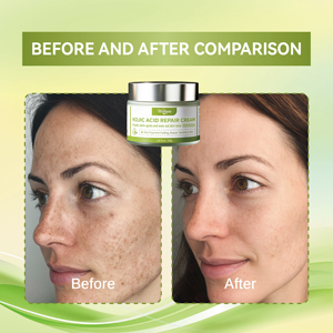 Crema Facial Antienvejecimiento con Niacinamida, Ácido Kójico y Colágeno Hidrolizado para Aclarar Manchas Oscuras, Eliminar <span class=keywords><strong>Melasma</strong></span> e Iluminar la Piel - Product Image 5