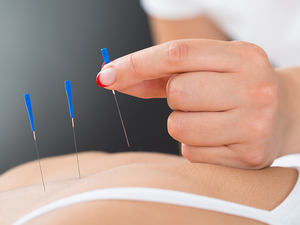 Disesuaikan ukuran yang berbeda steril dengan tabung 500Pcs akupunktur jarum kering akupunktur medis Tiongkok - Product Image 5