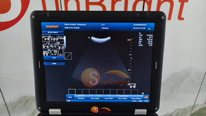 Mesin USG Medis Laptop Profesional VET Color <span class=keywords><strong>Doppler</strong></span> - Product Image 5