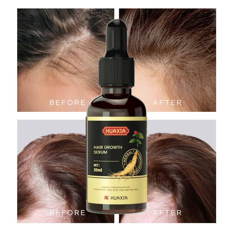 Huaxia Natural Organic Ginseng Herbal Hair Care Treatment Anti Loss Regrowth Hair Growth Oil Serum