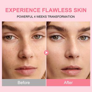 Siero Schiarente per Macchie Scure con Niacinamide e Acido Tranexamico per il Viso Anti-Età Sbiancante Pelle Luminosa Complexe Illuminante - Product Image 3