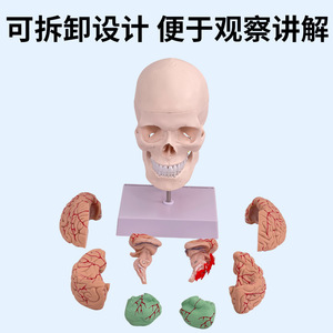 Modèle de crâne humain 1:1 ; Modèle de crâne avec vertèbres cervicales ; Modèle de crâne avec cerveau ; Modèle d'anatomie du cerveau - Product Image 3